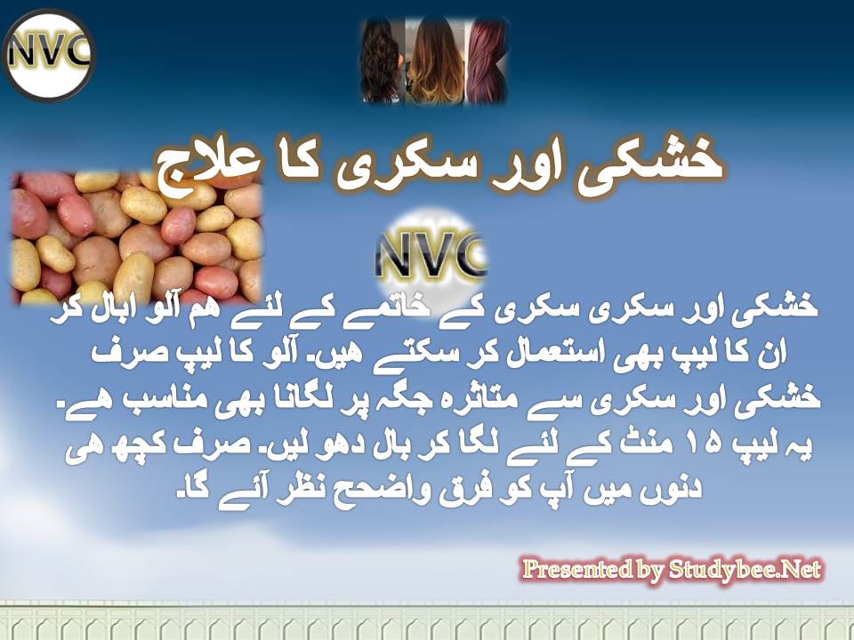 treat khuskhi sikri
